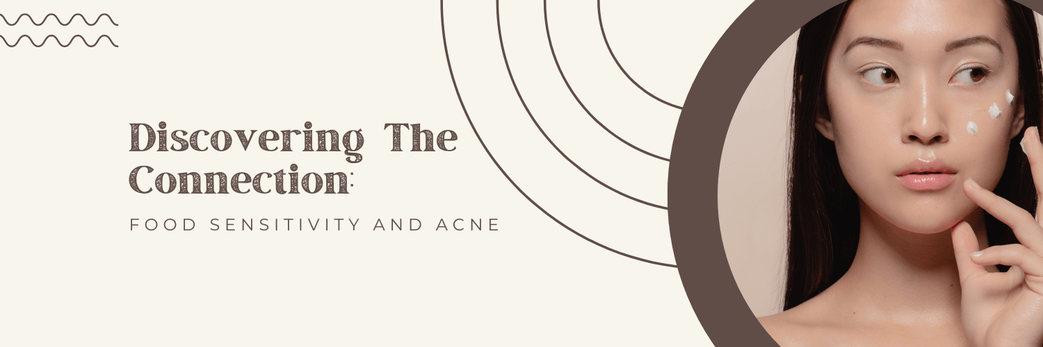 Discovering The Connection Food Sensitivity And Acne